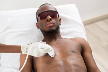 3 Myths About Laser Hair Removal For Dark Skin