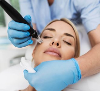 6 Reasons to Start Microneedling in Your 30s